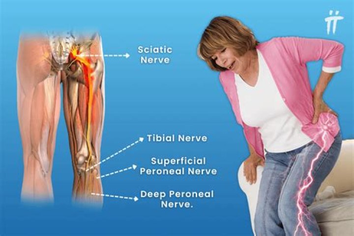 Are recliners good for sciatica?