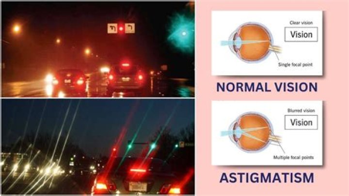 Can double vision be caused by astigmatism?