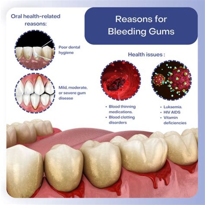 Do gums have skin? | ContextResponse.com
