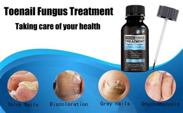 Does grapefruit seed extract kill toenail fungus?