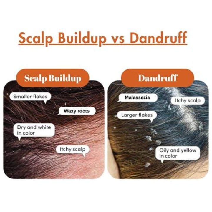How do you get rid of scalp buildup naturally?