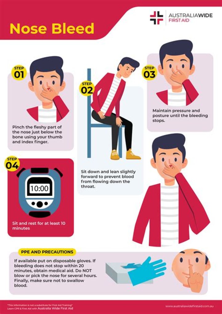 How long should a bloody nose last?