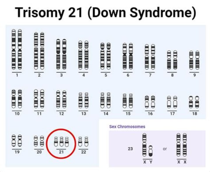 What disorder is trisomy of chromosome 21?