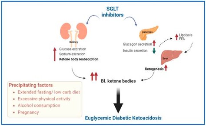 Will diet soda affect ketosis?